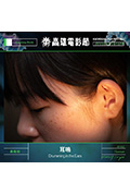 《耳鳴》封面